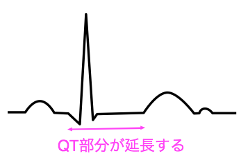 QT延長症候群