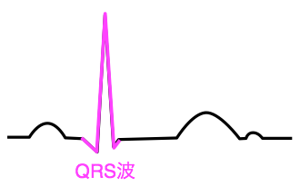 QRS波　心電図